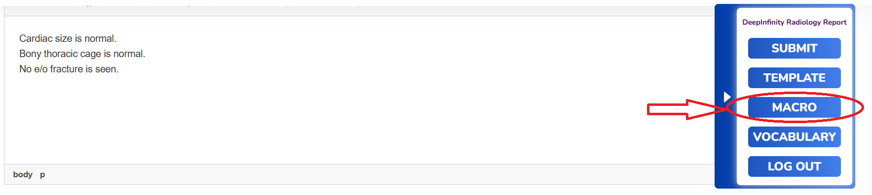 How to Add Macro